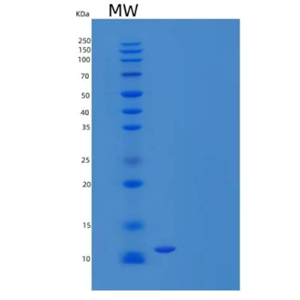 Recombinant Mouse S100 Calcium Binding Protein B/S100B Protein(C-6His)