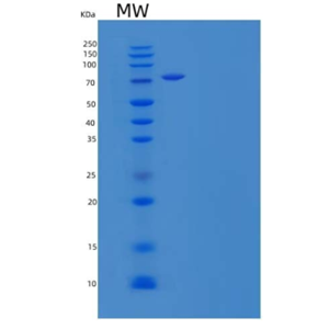 Recombinant Mouse Scavenger Receptor B2/SR-B2/LIMPII/CD36L2 Protein(N-6His)