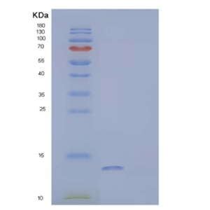 Recombinant Human Protein FAM19A4/FAM19A4 Protein(N-6His)