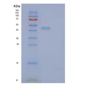 Recombinant Human ER Resident Protein 44/ERp44/TXNDC4 Protein(C-6His)