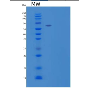 Recombinant Human E-Selectin//ELAM1/CD62E Protein(C-6His)