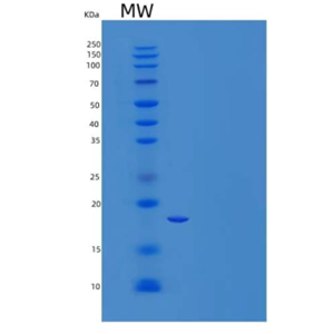 Recombinant Human Eukaryotic Translation Initiation Factor 5A-2/EIF5A2 Protein(N-6His)