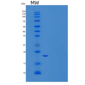 Recombinant Human Eukaryotic Translation Initiation Factor 5A-2/EIF5A2 Protein(N-6His),Recombinant Human Eukaryotic Translation Initiation Factor 5A-2/EIF5A2 Protein(N-6His)