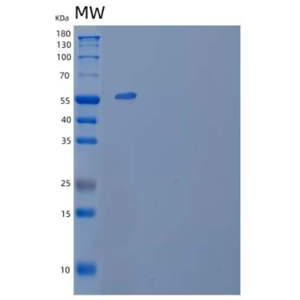 Recombinant Human Prolyl 4-Hydroxylase Subunit Beta Protein,Recombinant Human Prolyl 4-Hydroxylase Subunit Beta Protein