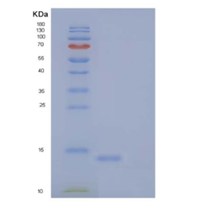 Recombinant Human BOC Protein/BOC Protein(C-6His)