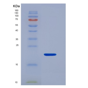 Recombinant Human CD16b / FCGR3B Protein, Biotinylated,Recombinant Human CD16b / FCGR3B Protein, Biotinylated