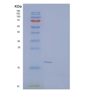 Recombinant Mouse Triggering Receptor Expressed on Myeloid Cells 2b/TREM-2b Protein(C-6His)