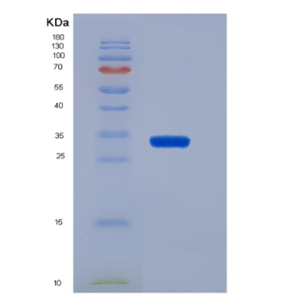 Recombinant Human CD19 / Leu-12 Protein (His tag),Recombinant Human CD19 / Leu-12 Protein (His tag)