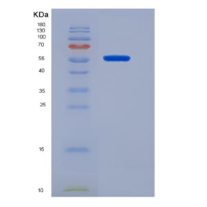 Recombinant Human CD19 Protein(C-Fc)