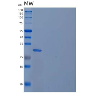 Recombinant Mouse TWEAK Receptor/TWEAK R/TNFRSF12A Protein(C-Fc),Recombinant Mouse TWEAK Receptor/TWEAK R/TNFRSF12A Protein(C-Fc)