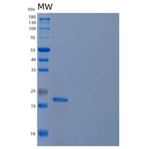 Recombinant Human Regenerating Islet-Derived Protein 4/RELP Protein(C-6His)