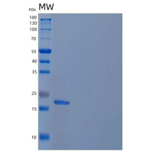 Recombinant Human Regenerating Islet-Derived Protein 4/RELP Protein(C-6His),Recombinant Human Regenerating Islet-Derived Protein 4/RELP Protein(C-6His)