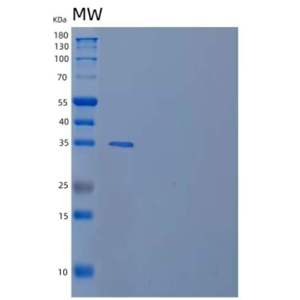 Recombinant Human Retinol-Binding Protein 3 Protein(N-6His)