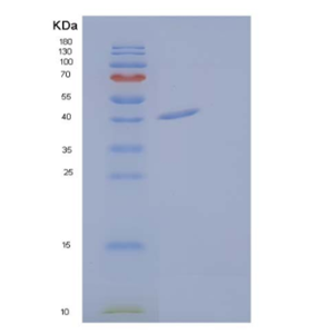 Recombinant Human Calreticulin-3/CALR3/CRT2 Protein