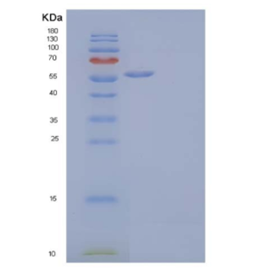 Recombinant Human MHC Class I Polypeptide-Related Sequence A/MICA Protein(C-Fc),Recombinant Human MHC Class I Polypeptide-Related Sequence A/MICA Protein(C-Fc)