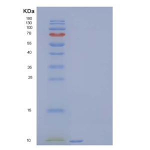Recombinant Human C-C Motif Chemokine 11/CCL11/Eotaxin Protein