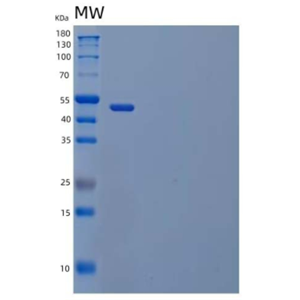 Recombinant Mouse Angiopoietin-Related Protein 4/ANGPTL4 Protein(C-Fc)