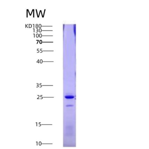 Eukaryotic Factor Related Apoptosis (FAS)