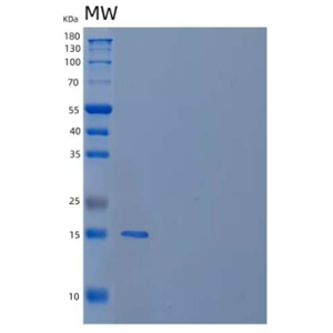 Recombinant Human Retinol-Binding Protein 5 Protein