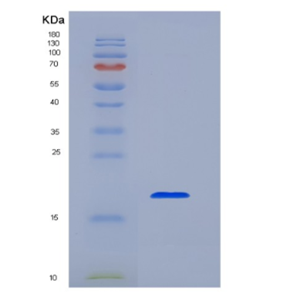 Eukaryotic Membrane Spanning 4 Domains Subfamily A, Member 1 (CD20),Eukaryotic Membrane Spanning 4 Domains Subfamily A, Member 1 (CD20)