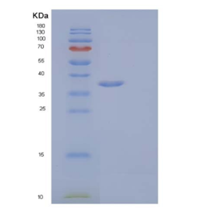 Recombinant Human Interleukin-1 receptor type 1/IL-1R-1 Protein