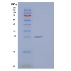 Recombinant Human Serpin B5/SERPINB5/Maspin Protein