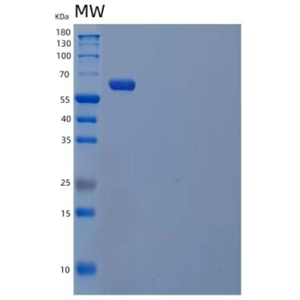 Recombinant Human Sialic Acid-Binding Ig-Like Lectin 9/Siglec 9/CD329 Protein(C-Fc),Recombinant Human Sialic Acid-Binding Ig-Like Lectin 9/Siglec 9/CD329 Protein(C-Fc)