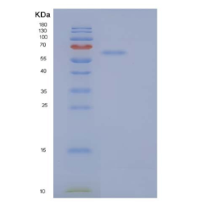 Recombinant Human Secretogranin-2/SCG2 Protein(C-6His),Recombinant Human Secretogranin-2/SCG2 Protein(C-6His)