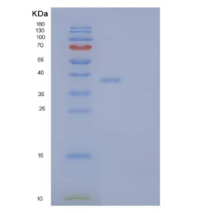 Recombinant Human Interleukin-1 receptor type 2/IL-1R-2 Protein,Recombinant Human Interleukin-1 receptor type 2/IL-1R-2 Protein