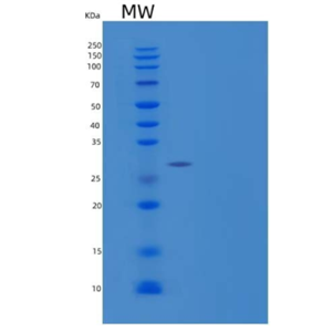 Recombinant Mouse Adiponectin/Acrp30/AdipoQ Protein(C-6His)