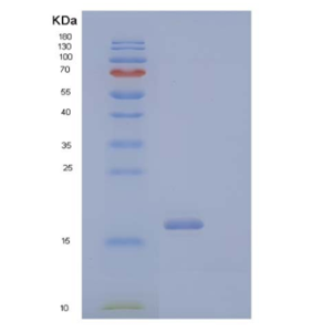 Recombinant Human CD40 Ligand/CD40L/TNFSF5 Protein