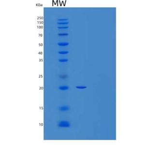 Recombinant Human Galectin-Related Protein/LGALSL Protein(C-6His)