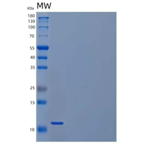 Recombinant Mouse C-C Motif Chemokine 21a/CCL21a//6CkineProtein,Recombinant Mouse C-C Motif Chemokine 21a/CCL21a//6CkineProtein