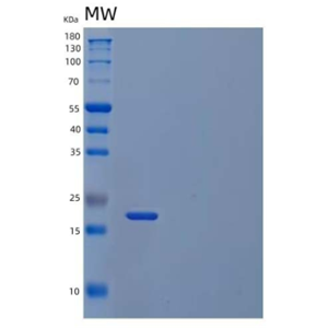 Recombinant Human SOD2/Mn-SOD Protein(C-6His, Cells)