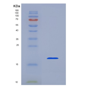 Recombinant Human Interleukin 1 Beta (IL1b),Recombinant Human Interleukin 1 Beta (IL1b)