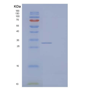 Recombinant Mouse Butyrophilin Subfamily 1 Member A1/BTN1A1 Protein(C-6His)