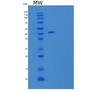 Recombinant Human N-Acetylneuraminate Synthase/NANS/SAS Protein(N-6His),Recombinant Human N-Acetylneuraminate Synthase/NANS/SAS Protein(N-6His)