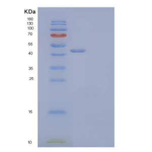 Recombinant Human CD44/MIC4 Protein(C-Fc),Recombinant Human CD44/MIC4 Protein(C-Fc)