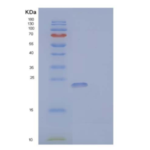 Recombinant Human Granulocyte Colony-Stimulating Factor/G-CSF Protein