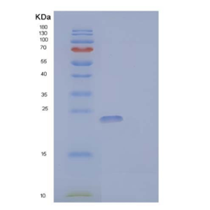 Recombinant Human Granulocyte Colony-Stimulating Factor/G-CSF Protein,Recombinant Human Granulocyte Colony-Stimulating Factor/G-CSF Protein