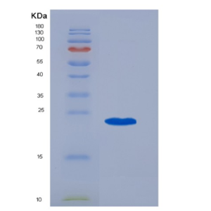 Recombinant Human CD20 / MS4A1 Protein (TrxA Tag),Recombinant Human CD20 / MS4A1 Protein (TrxA Tag)