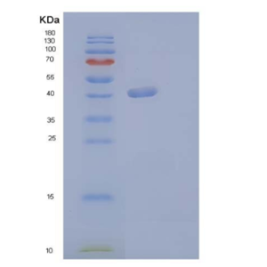 Recombinant Human G-CSF / CSF3 Protein (Fc tag)