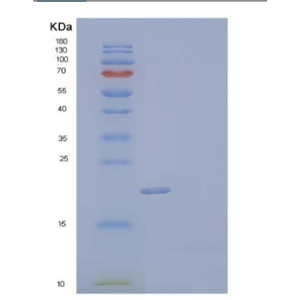 Recombinant Human SOD2/Mn-SOD Protein(N-6His)