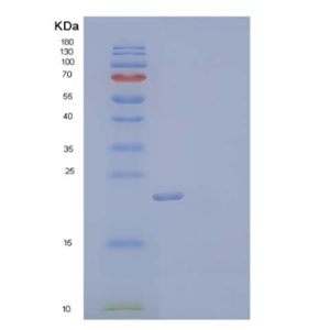 Recombinant Human Stathmin/STMN1 Protein(C-6His)