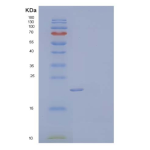 Recombinant Mouse C-X-C Motif Chemokine 16/CXCL16/SR-PSOX Protein(C-6His)