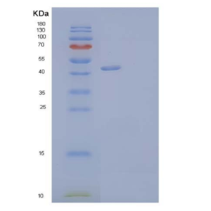 Recombinant Human Netrin-G1/NTNG1 Protein(C-6His),Recombinant Human Netrin-G1/NTNG1 Protein(C-6His)