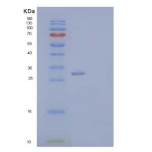 Recombinant Human Neurexophilin-1/NXPH1 Protein(C-6His)