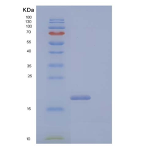 Recombinant Human CD99 Antigen-Like Protein 2/CD99L2 Protein(C-6His),Recombinant Human CD99 Antigen-Like Protein 2/CD99L2 Protein(C-6His)