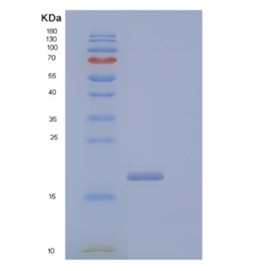 Recombinant Human CD99 Antigen-Like Protein 2/CD99L2 Protein(C-6His)