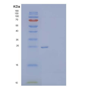 Recombinant Human Neuronal Acetylcholine Receptor Subunit β-3/CHRNB3 Protein(C-6His)